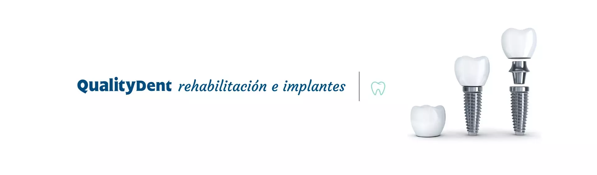 banner-rehabilitacioneimplantes-qualitydent